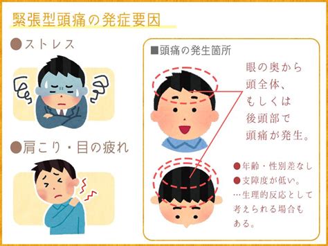 起床偏頭痛|頭痛の要因1位は、「気圧の変化」～気象からヘルスケアを考える